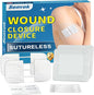 Zip Stitch Wound Closure Strips | 2-Pack Stitchless Butterfly Bandages | Adjustable Tension for Painless Laceration Repair, Post-Surgery Care & Emergency First Aid