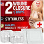 Emergency Wound Closure Strips - 2pk - Laceration Closure Kit - Stitchless & Easy to Use - Butterfly Bandages