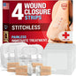 Emergency Wound Closure Strips - 4pk - 2 Types Laceration Closure Kit - Stitchless & Easy to Use - Butterfly Bandages